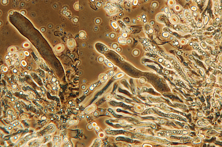 Plasmodio vs Phanerochaete?-foto3517(Hyphoderma roseocremeum